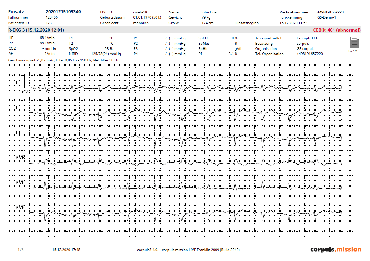 Format „Ganze Ableitungen“ (25mm/s) – CEB® „Abnormaler Zustand“ und Vectorloops