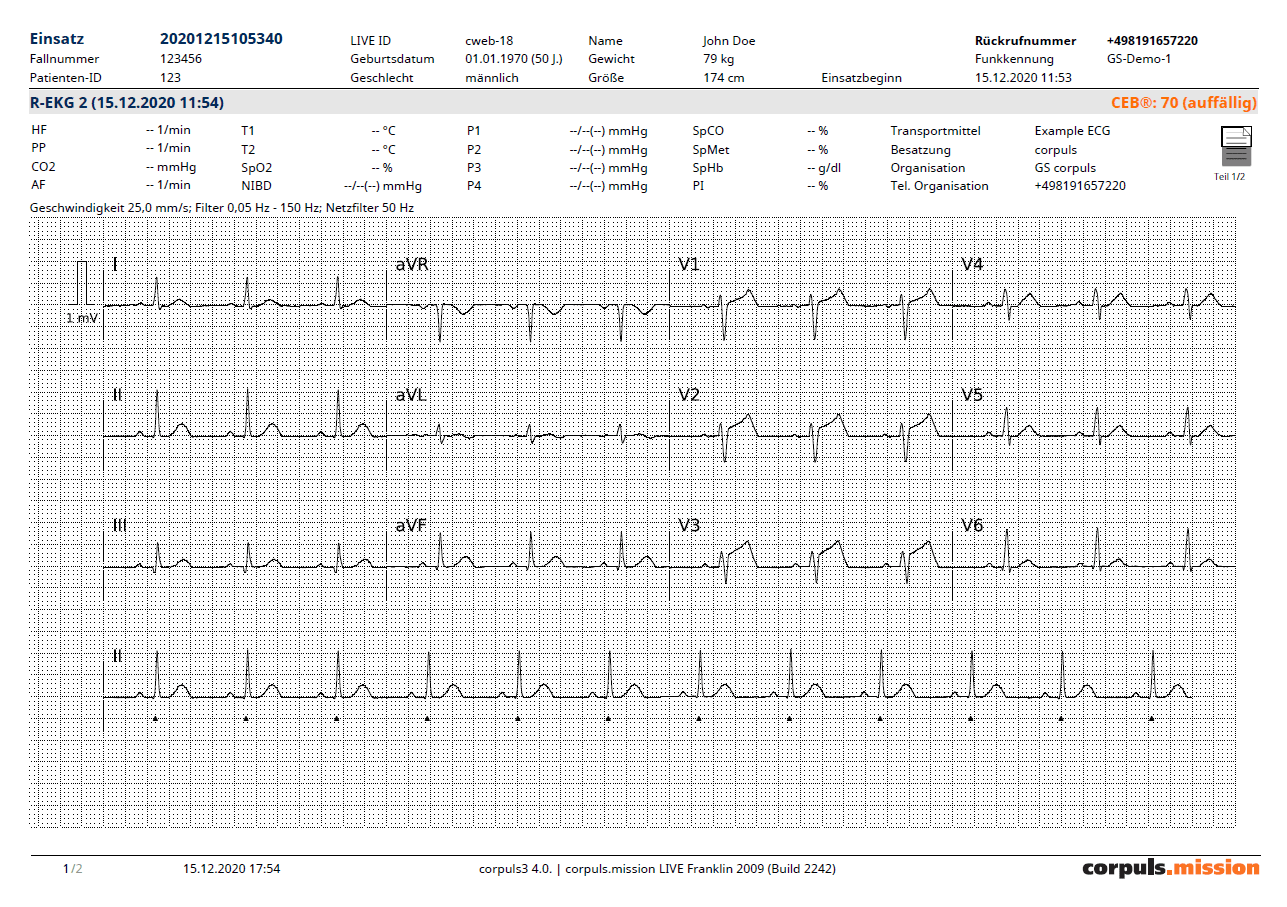 Format „Ableitungsausschnitte“ (25mm/s) - CEB® „Gefahrenzone“